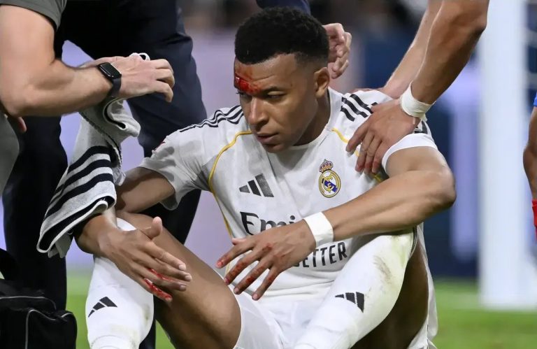 Mbappé ensanguentado e polémica no Real Madrid-Girona